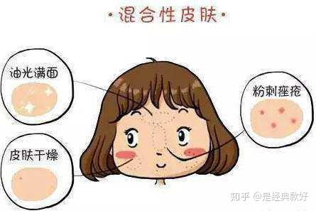 分享:混合性皮肤护理补水方法
