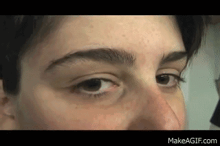 这在医学上被称为 酒精体位性眼球震颤(positional alcohol nystagmus