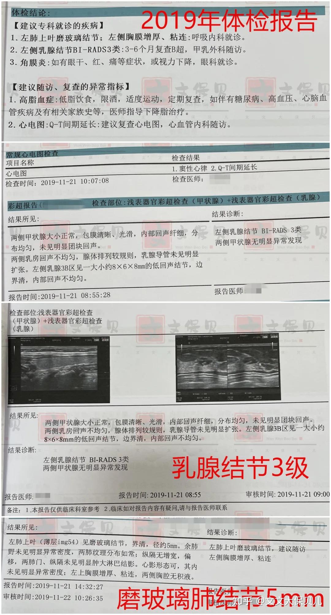 核保实例曾有磨玻璃肺结节5mm乳腺结节3级重疾险标体承保