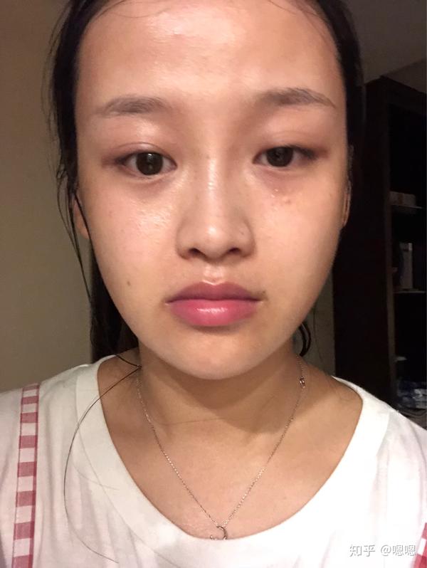 大概是这样的 ～ 素颜黑眼圈大脑门 前置摄像头