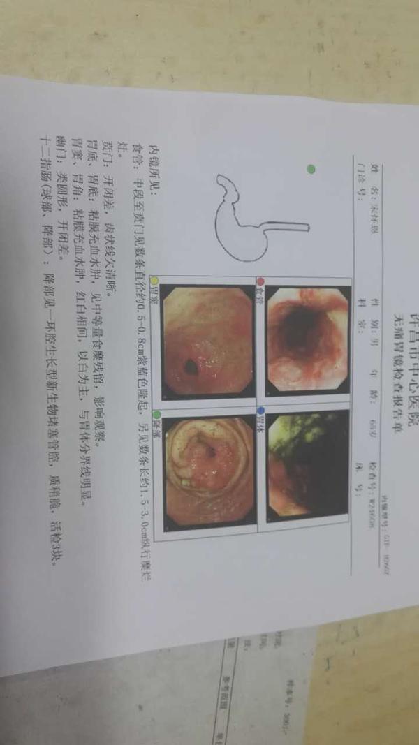 十二指肠肿瘤手术解答?