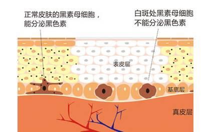 神经肽刺激黑素细胞,促进和色素合成所需关键酶类的转录以及活化 3.