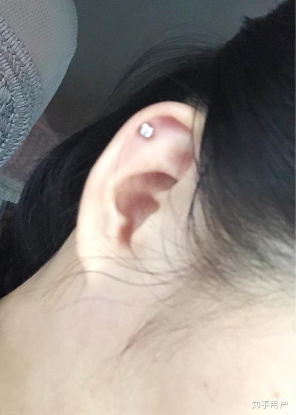 打耳洞之后如何避免感染?