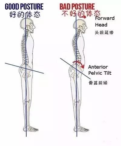 骨盆前倾你的翘臀