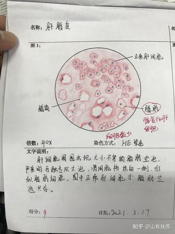 病理红蓝铅笔彩铅绘图