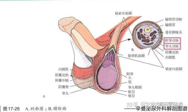 阴囊入路的显微精索结扎术难度大,因为精索解剖位置越低,静脉分支越多