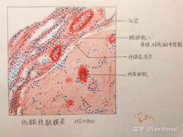 大学病理学红蓝铅笔绘图