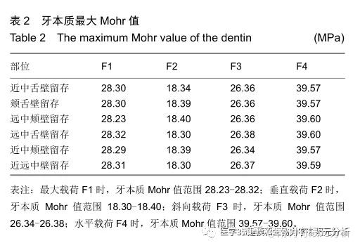 金合金桩核冠修复下颌第一磨牙两壁缺损的三维有限元分析