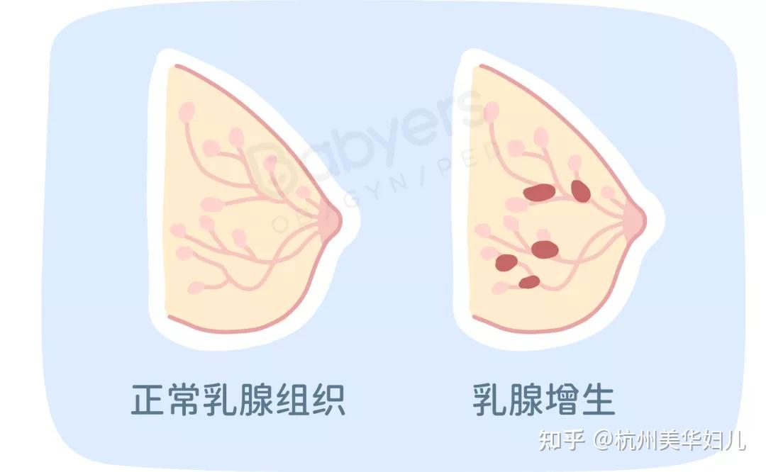 杭州美华提醒:一张图教你「乳房自检」,乳腺问题早发现!