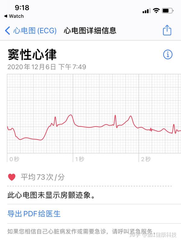 如何安全开通apple watch ecg心电功能,亲测通过