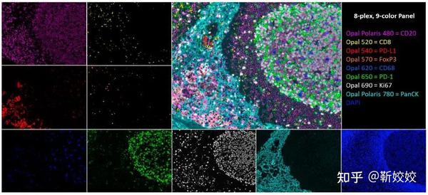 Multiplex Tissue Imaging Encyclopedia Mdpi Hot Sex Picture