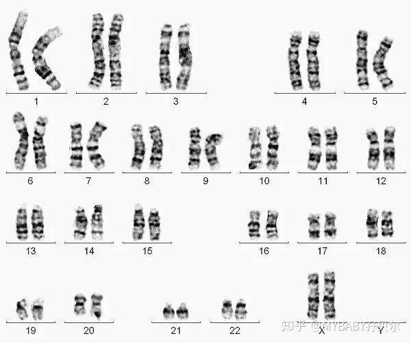 人类正常染色体核型图(女性:46,xx)