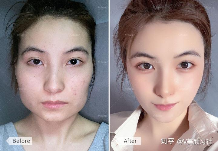 脸上肉多还属于大小脸用舌头顶腮帮子左右脸的紧致度不一样是因为左边