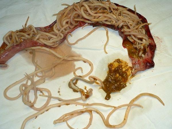 蛔虫填满了整个肠道,造成肠梗阻,手术