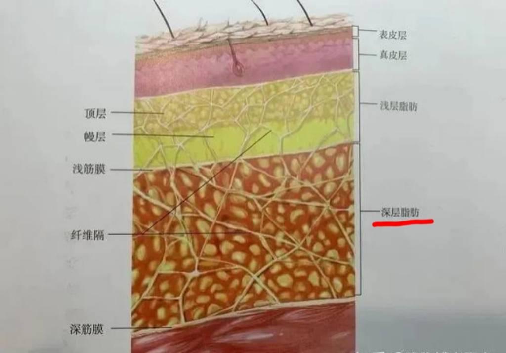 面部吸脂导致组织变空洞原因是什么