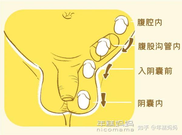 小心耽误孩子男宝蛋蛋出现这几种情况要重视越早检查越好