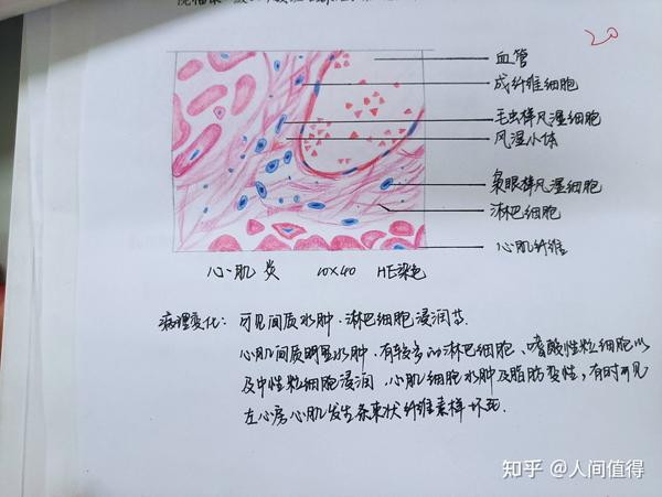 病理红蓝铅笔绘图