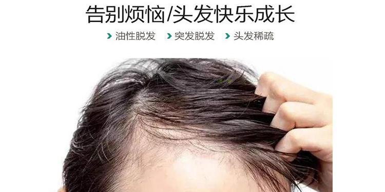 为什么女性脱发厉害呢