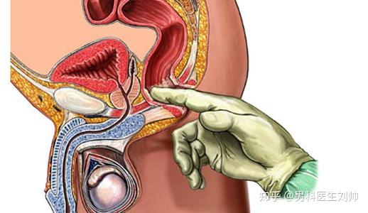 前列腺炎,为什么让男性在床上有苦难言?