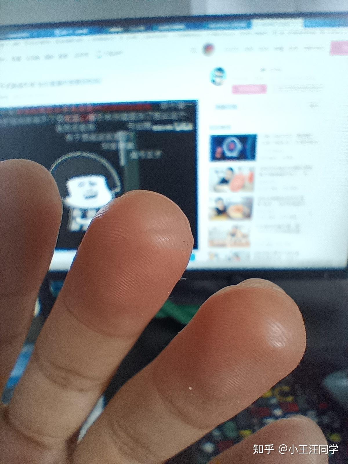 为什么我弹了四年吉他手上的茧子还是不平滑很容易出现杂音击勾弦也