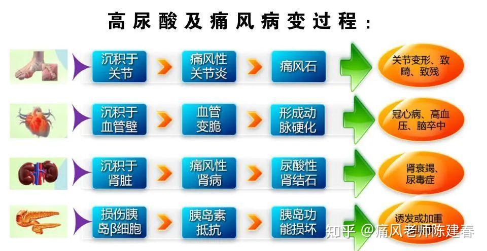 这些痛风的知识,你需要有所了解!