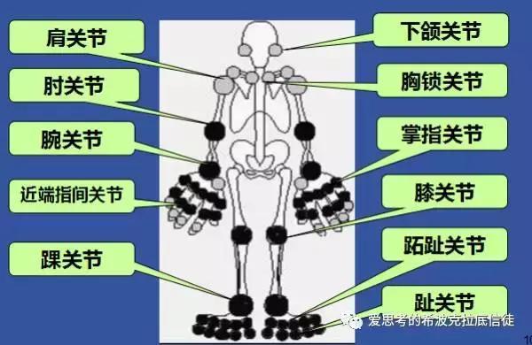 (主要累及掌指关节,近端指间关节,腕关节等小关节)