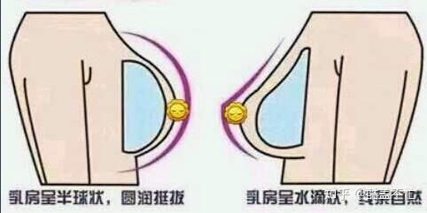 乳房假体该怎么选择?圆盘形还是水滴形?要多大的假体?