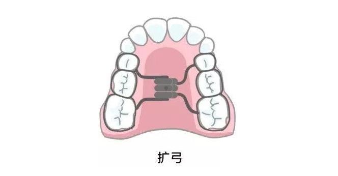 闫燕医生牙齿扩弓会让脸型变大吗