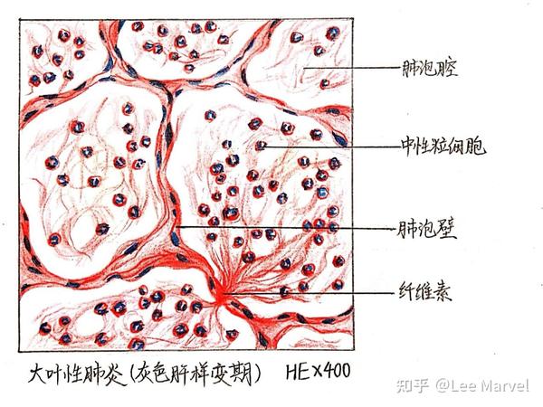 大学病理学红蓝铅笔绘图