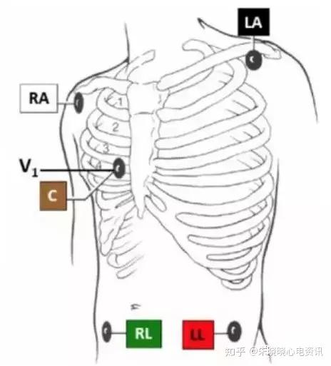 你做的心电图标准吗来看看这些需要注意的细节