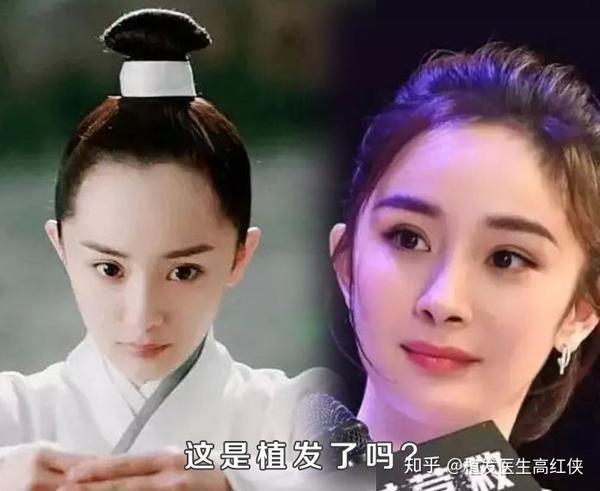 看看明星的头发,你的发际线还好吗? !