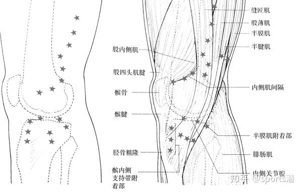 膝关节疼痛的原因