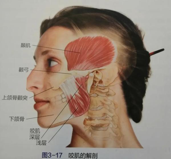 图片来源:基础临床按摩疗法:解剖学与治疗学的结合( 第3版)编辑 咬肌