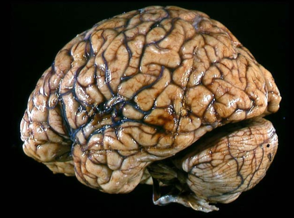 白质以及脑脊液等等,科学研究主要集中在在大脑灰质和白质