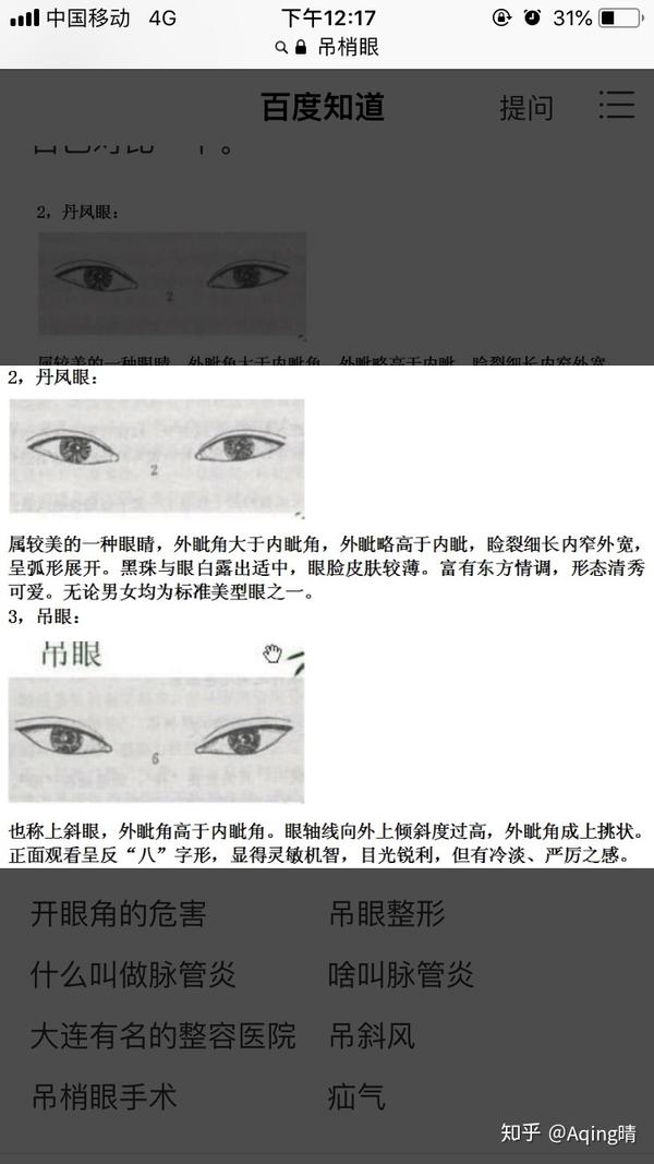 看评论明白啦 可能是是吊眼