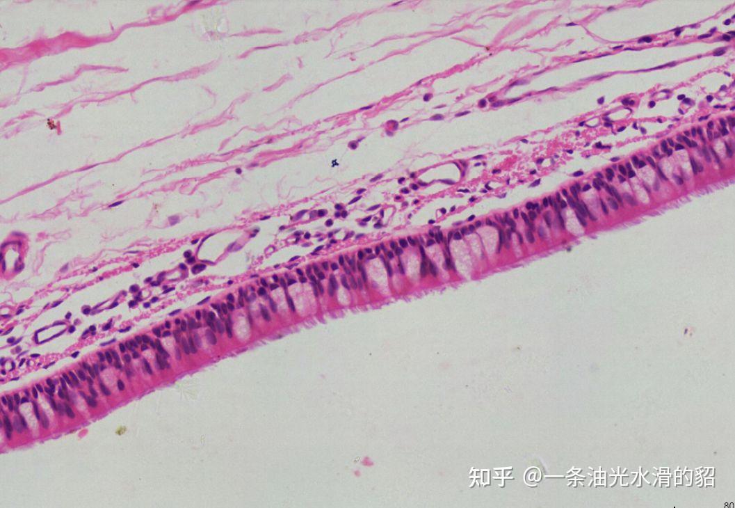 上皮细胞分单层和复层请问怎样理解假复层纤毛柱状上皮只有一层