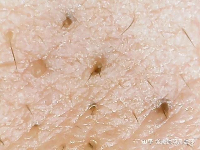 鼻子上的黑头毛孔放大几百倍上千倍的照片吓到我了这毛孔里到底是什么