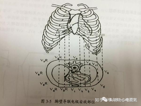 多导联心电图检查