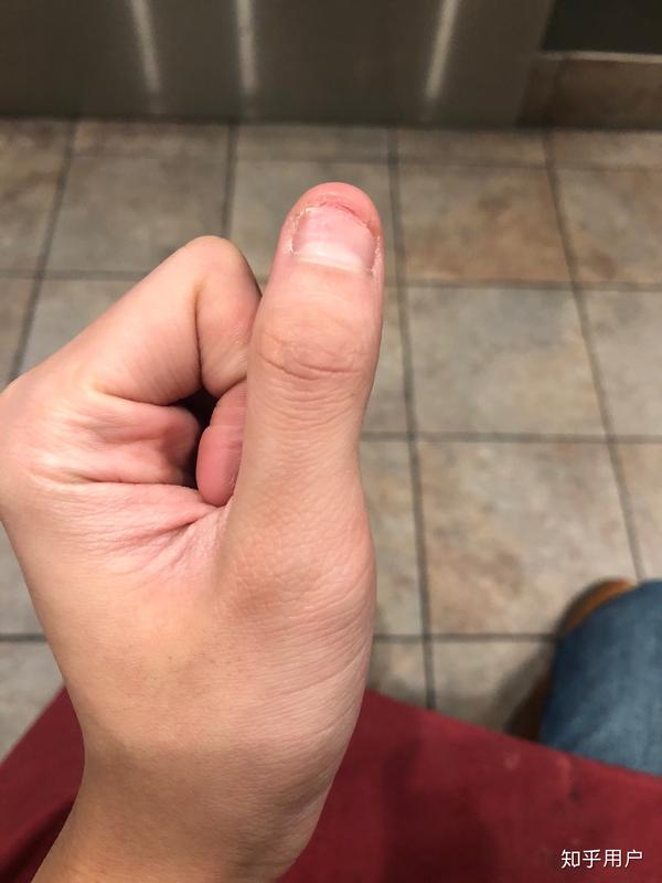 孩子吃手到底要不要干涉?