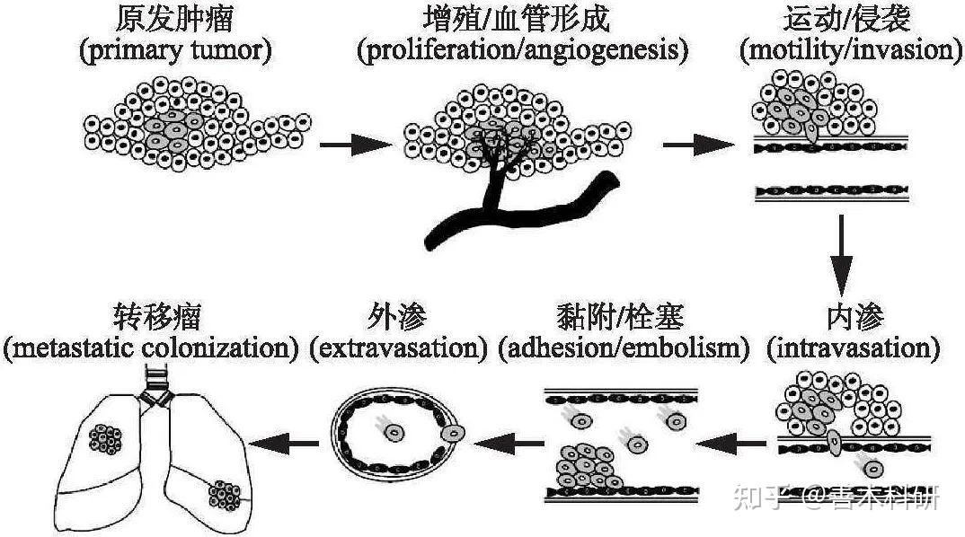 用一张图理清肿瘤转移机制 知乎