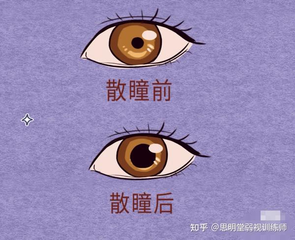 什么是散瞳验光?