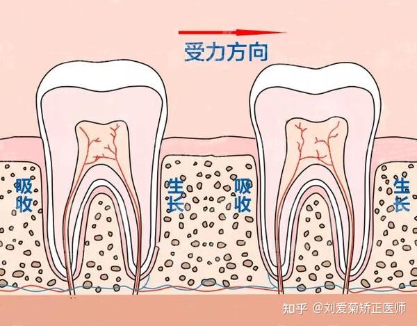 牙齿矫正会对牙神经造成不良影响吗?