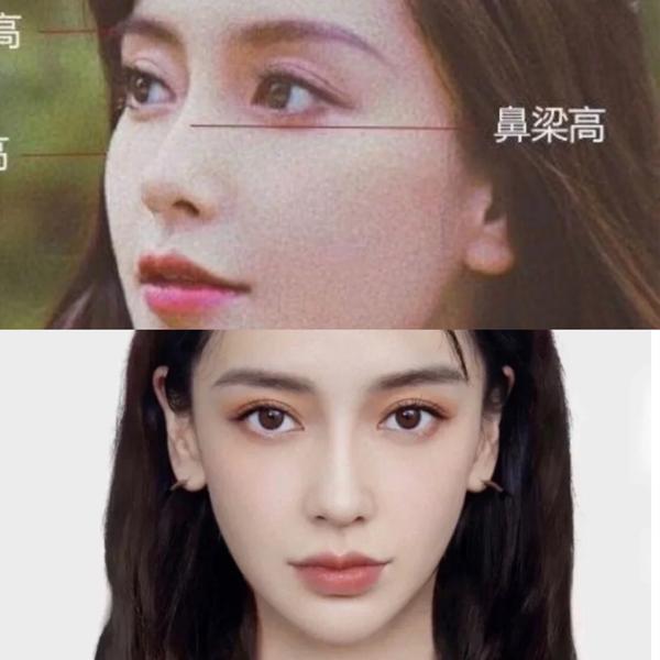 angelababy 新剧鼻子又透光,就是隆鼻了吗?看完我的分析就明白了!