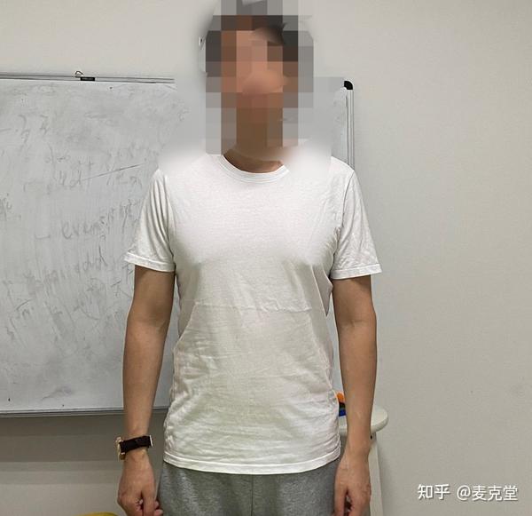 男生胸部脂肪过多(胸部雌化)的穿衣激凸问题——通过定制t恤从外部