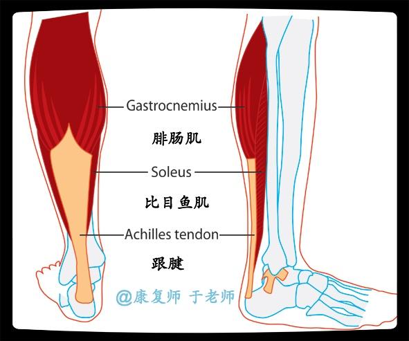 比目鱼肌被扭到,走路疼,不肿,会不会骨折压疼