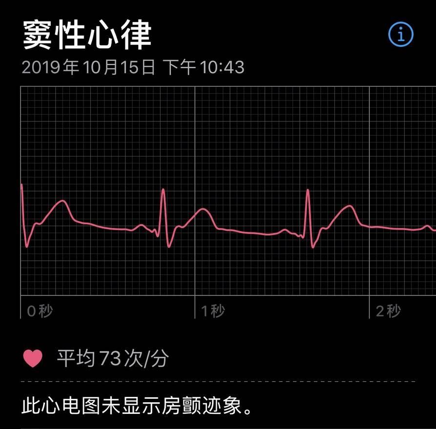 如何开通 applewatch 心电图功能