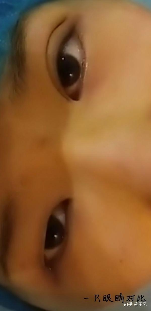 这是刚做好一只眼睛的时候,感觉差距还是很大的.