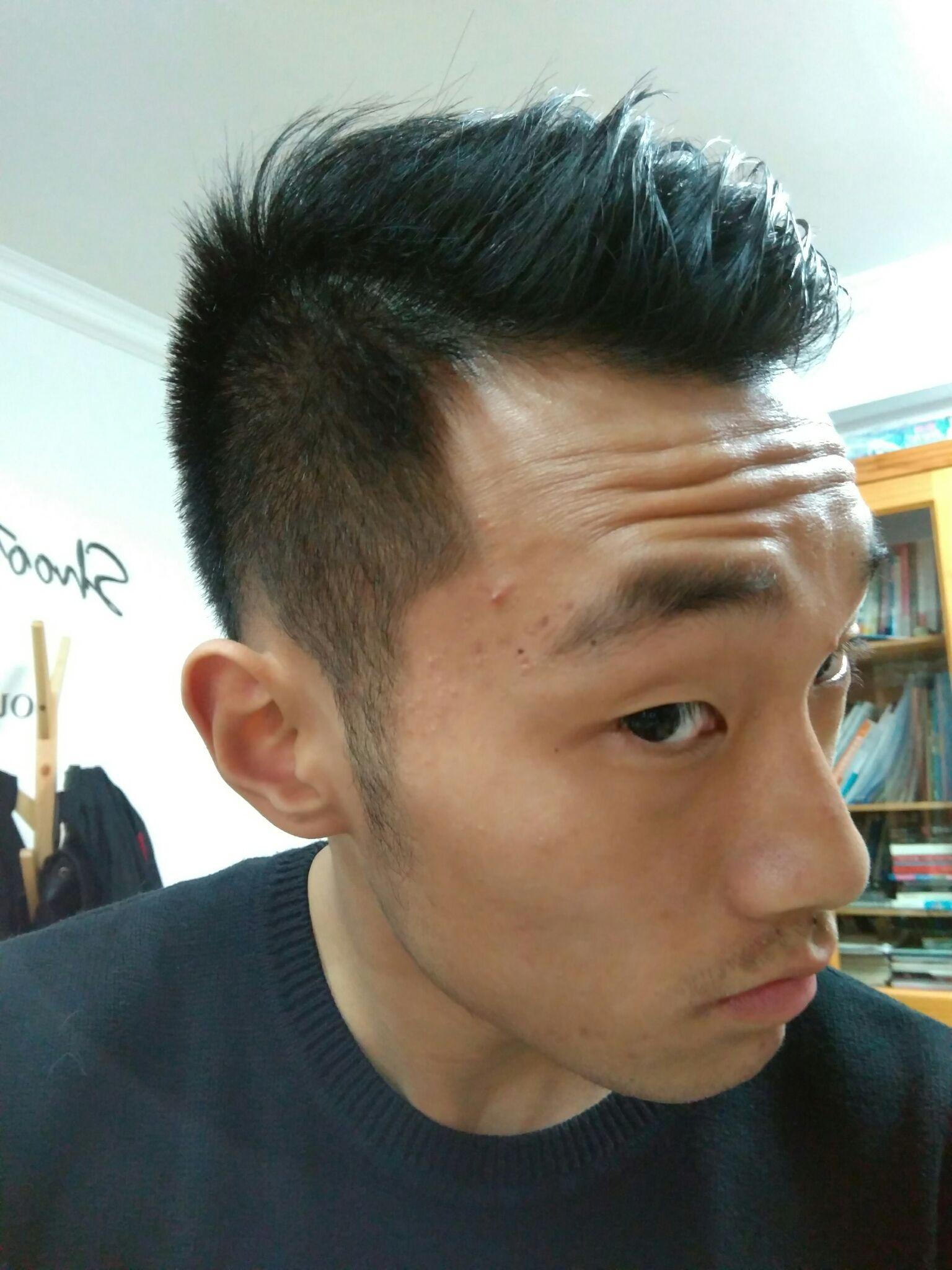 发际线高且m型发际线的男人适合什么发型额头较大