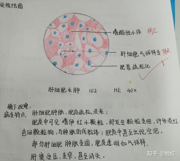 病理学红蓝铅笔绘图