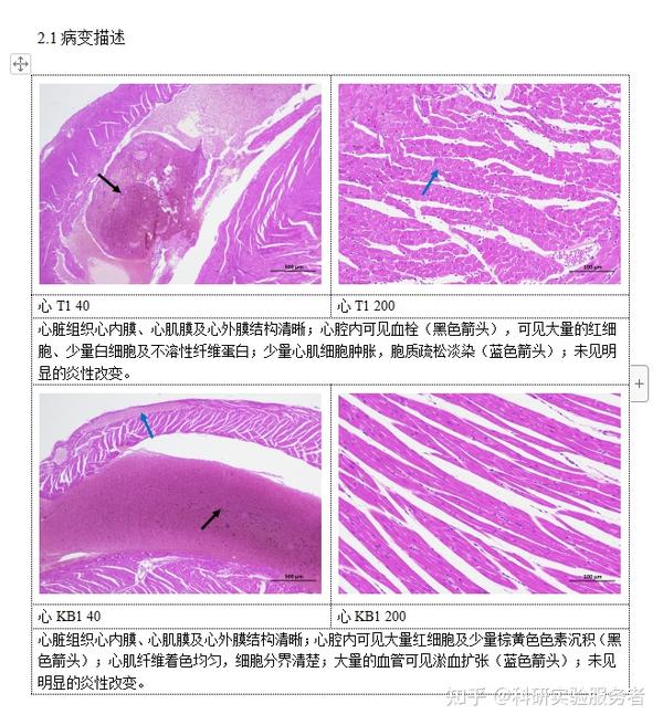 石蜡切片he染色实验结果病理分析检查报告上海郑核